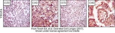 Anti-VEGFA antibody used in IHC (Paraffin sections) (IHC-P). GTX102643