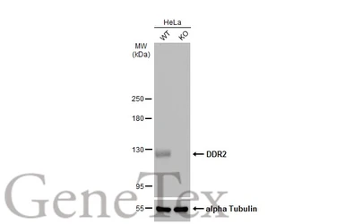 Anti-DDR2 antibody [C2C3], C-term used in Western Blot (WB). GTX102651