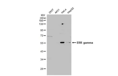 Anti-ERR gamma antibody used in Western Blot (WB). GTX102664