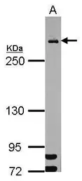 Anti-MDC1 antibody [N2N3] used in Western Blot (WB). GTX102673