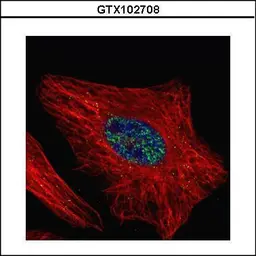 Anti-WTAP antibody used in Immunocytochemistry/ Immunofluorescence (ICC/IF). GTX102708