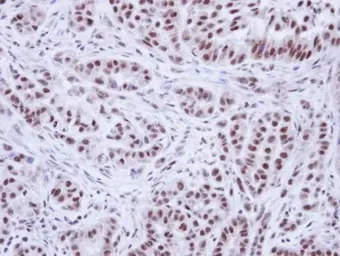 Anti-WTAP antibody used in IHC (Paraffin sections) (IHC-P). GTX102708