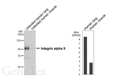 Anti-Integrin alpha 9 antibody [N1N2], N-term used in Western Blot (WB). GTX102728