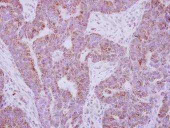 Anti-IL10 Receptor alpha antibody used in IHC (Paraffin sections) (IHC-P). GTX102731