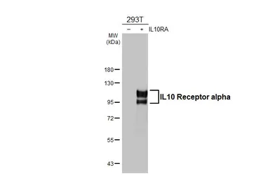 Anti-IL10 Receptor alpha antibody used in Western Blot (WB). GTX102731