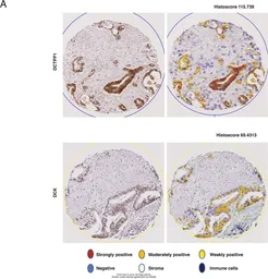 Anti-DCK antibody used in Immunohistochemistry (IHC). GTX102800
