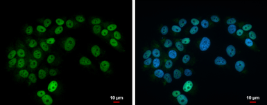 Anti-Islet 1 antibody used in Immunocytochemistry/ Immunofluorescence (ICC/IF). GTX102807