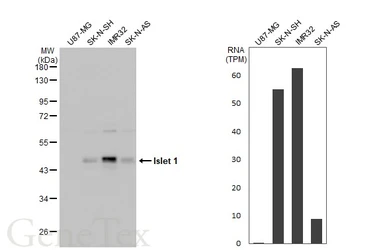 Anti-Islet 1 antibody used in Western Blot (WB). GTX102807