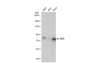 Anti-AF9 antibody used in Western Blot (WB). GTX102835