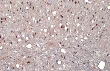 Anti-AF9 antibody used in IHC (Paraffin sections) (IHC-P). GTX102835
