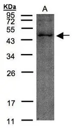 Anti-TMLHE antibody [N2C3] used in Western Blot (WB). GTX102856