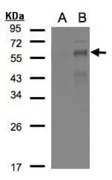 Anti-EGR2 antibody used in Western Blot (WB). GTX102912