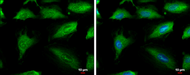 Anti-Aconitase 1 antibody [N1C1] used in Immunocytochemistry/ Immunofluorescence (ICC/IF). GTX102974