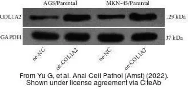 Anti-COL1A2 antibody [C2C3], C-term used in Western Blot (WB). GTX102996
