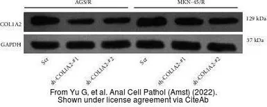 Anti-COL1A2 antibody [C2C3], C-term used in Western Blot (WB). GTX102996