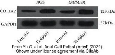 Anti-COL1A2 antibody [C2C3], C-term used in Western Blot (WB). GTX102996