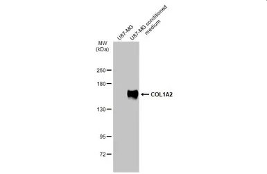 Anti-COL1A2 antibody [C2C3], C-term used in Western Blot (WB). GTX102996