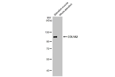 Anti-COL1A2 antibody [C2C3], C-term used in Western Blot (WB). GTX102996