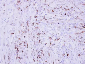 Anti-Collagen III antibody [C2C3], C-term used in IHC (Paraffin sections) (IHC-P). GTX102997