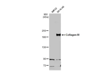 Anti-Collagen III antibody [C2C3], C-term used in Western Blot (WB). GTX102997