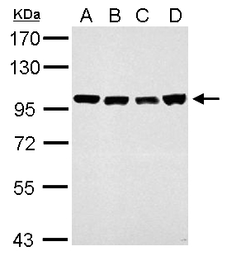 Anti-CSE1L antibody used in Western Blot (WB). GTX103005