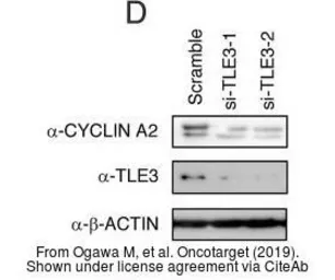 Anti-Cyclin A2 antibody used in Western Blot (WB). GTX103042
