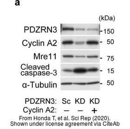 Anti-Cyclin A2 antibody used in Western Blot (WB). GTX103042