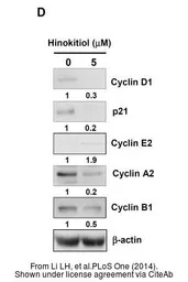 Anti-Cyclin A2 antibody used in Western Blot (WB). GTX103042