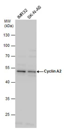 Anti-Cyclin A2 antibody used in Western Blot (WB). GTX103042