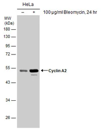 Anti-Cyclin A2 antibody used in Western Blot (WB). GTX103042