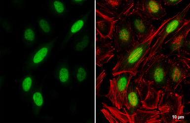 Anti-Cyclin A2 antibody used in Immunocytochemistry/ Immunofluorescence (ICC/IF). GTX103042