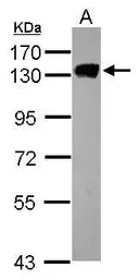 Anti-MCM2 antibody [N1N2], N-term used in Western Blot (WB). GTX103071