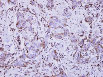 Anti-Interferon gamma Receptor 1 antibody used in IHC (Paraffin sections) (IHC-P). GTX103098