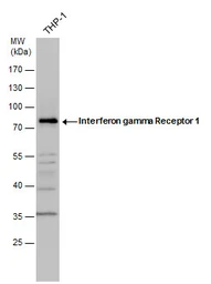 Anti-Interferon gamma Receptor 1 antibody used in Western Blot (WB). GTX103098