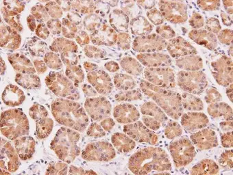Anti-DAK antibody used in IHC (Paraffin sections) (IHC-P). GTX103102