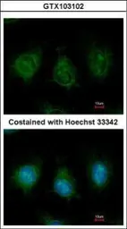 Anti-DAK antibody used in Immunocytochemistry/ Immunofluorescence (ICC/IF). GTX103102