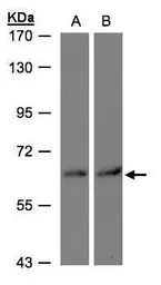 Anti-DAK antibody used in Western Blot (WB). GTX103102