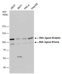Anti-DNA ligase III antibody used in Western Blot (WB). GTX103172