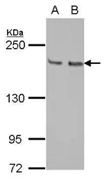 Anti-KIF14 antibody [N1N2], N-term used in Western Blot (WB). GTX103196