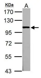 Anti-alpha Actinin 3 antibody used in Western Blot (WB). GTX103216