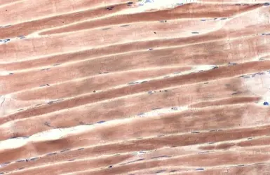 Anti-alpha Actinin 2 antibody [N1N3] used in IHC (Paraffin sections) (IHC-P). GTX103219