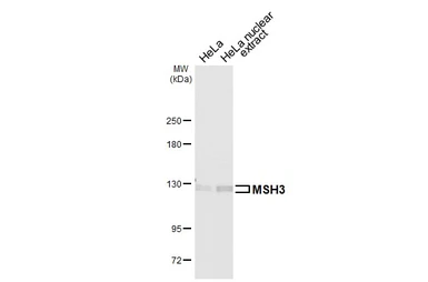 Anti-MSH3 antibody [N1N2], N-term used in Western Blot (WB). GTX103228
