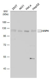 Anti-USP4 antibody used in Western Blot (WB). GTX103237