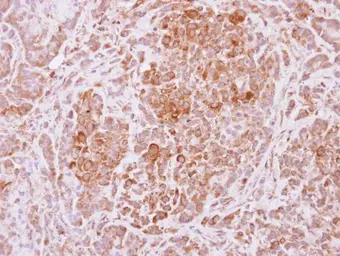 Anti-USP4 antibody used in IHC (Paraffin sections) (IHC-P). GTX103237
