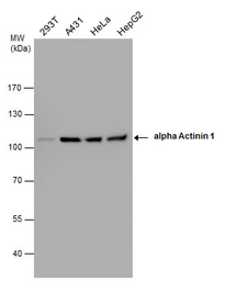 Anti-alpha Actinin 1 antibody [N2N3] used in Western Blot (WB). GTX103240