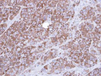 Anti-alpha Actinin 1 antibody [N2N3] used in IHC (Paraffin sections) (IHC-P). GTX103240