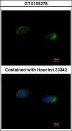 Anti-Homer1 antibody used in Immunocytochemistry/ Immunofluorescence (ICC/IF). GTX103278