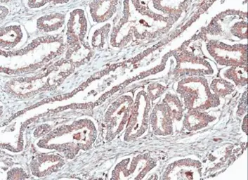 Anti-Homer1 antibody used in IHC (Paraffin sections) (IHC-P). GTX103278