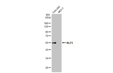 Anti-KLF5 antibody used in Western Blot (WB). GTX103289