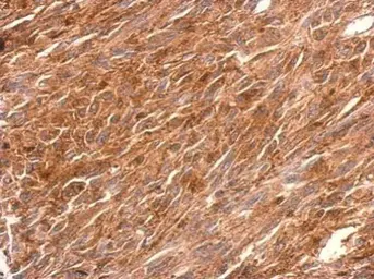 Anti-PGCP antibody used in IHC (Paraffin sections) (IHC-P). GTX103290
